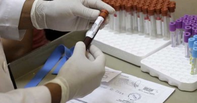 Veliki priliv pacijenata u čačansku bolnicu, 71 hospitalizovan, 6 sa teškom kliničkom slikom i 1 na respiratoru Veliki priliv pacijenata u čačansku bolnicu, 71 hospitalizovan, 6 sa teškom kliničkom slikom i 1 na respiratoru