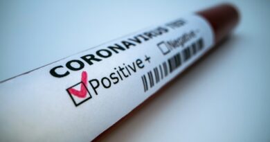 U Moravičkom okrugu testirano 380 uzoraka, od kojih je 81 pozitivan U Moravičkom okrugu testirano 380 uzoraka, od kojih je 81 pozitivan